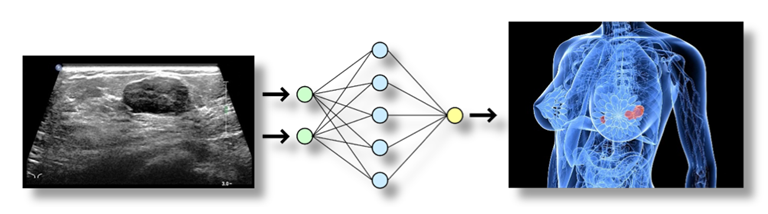 L'immagine mostra uno schema esemplificativo della rete neurale di SABREEN